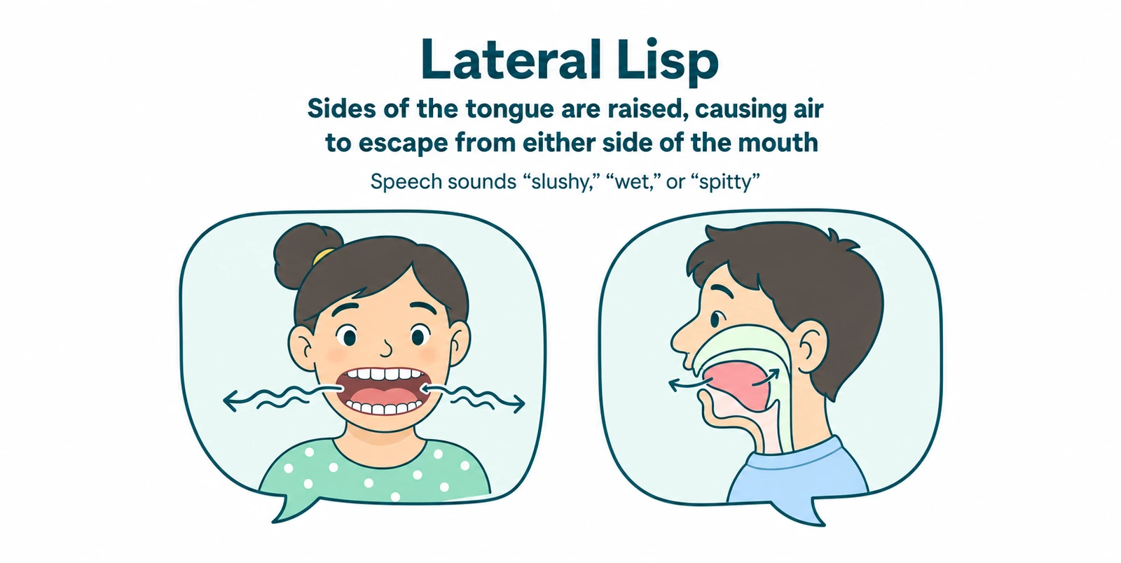 Illustration of a lateral lisp
