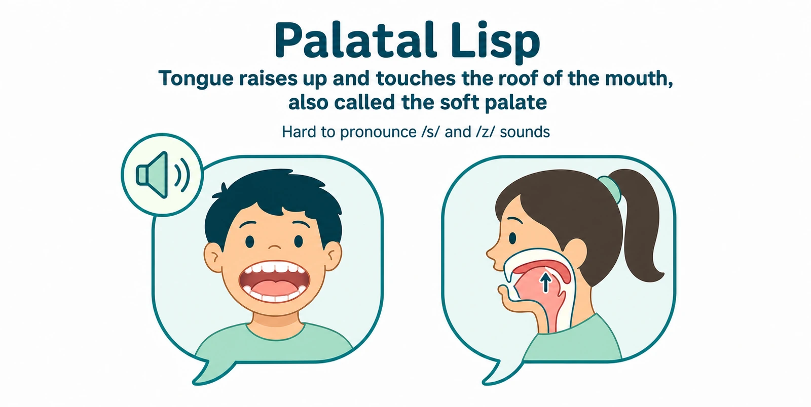 Illustration of a palatal lisp