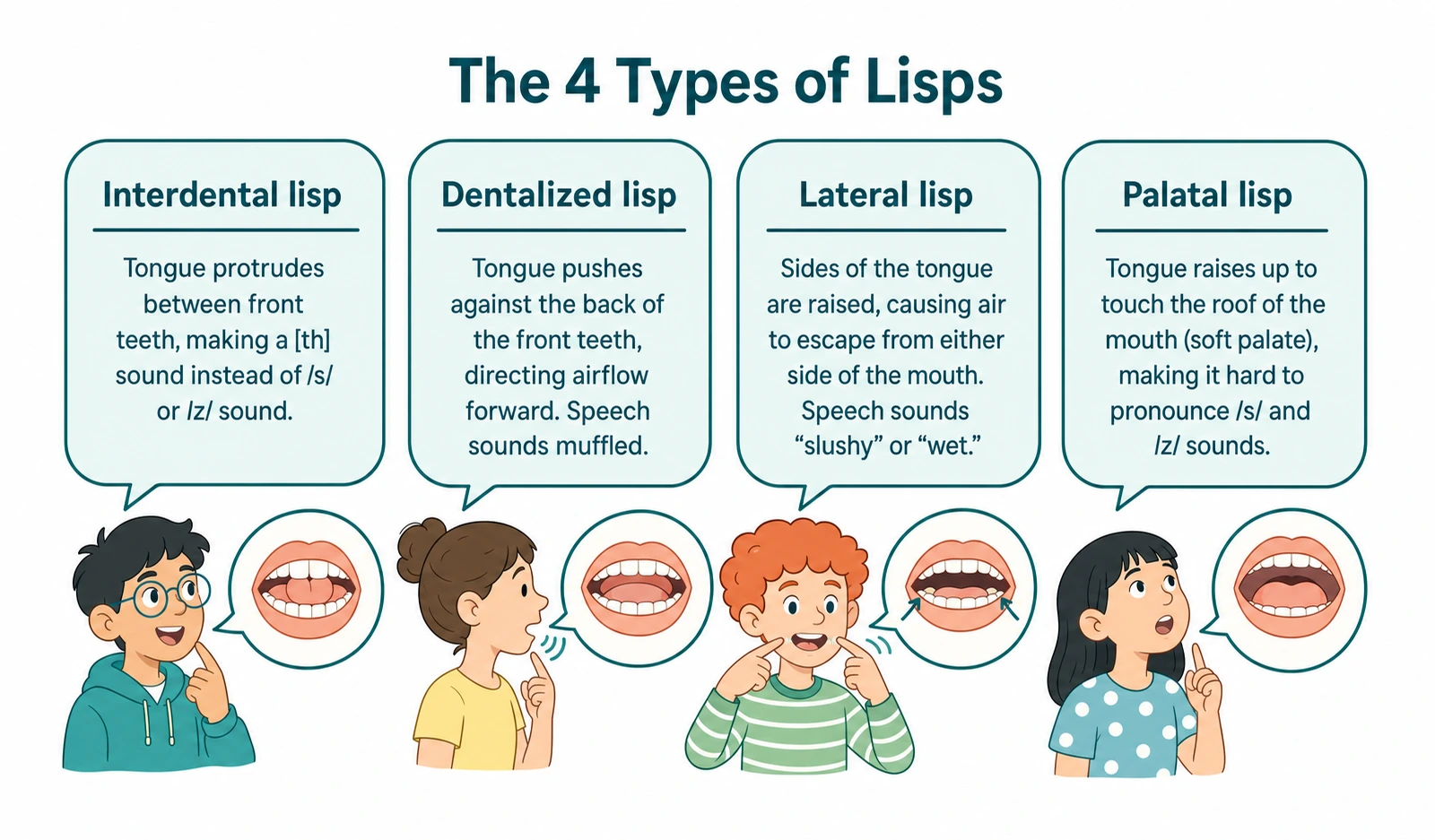 Illustration of the four types of lisps 